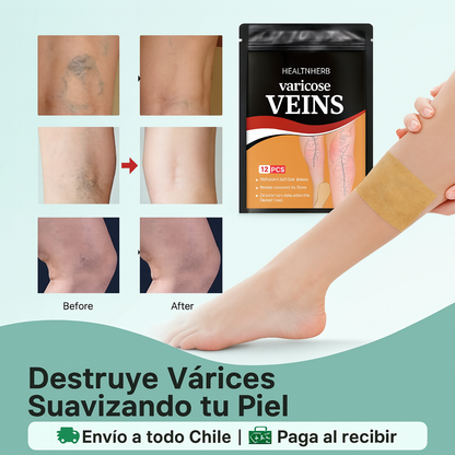 VarixPatch™ | Pack de Parches Naturales para Várices